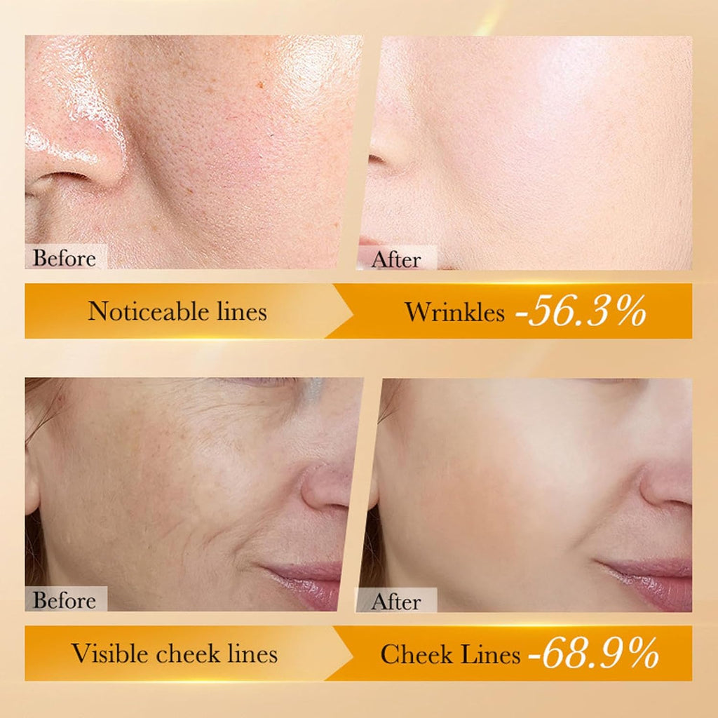 Retinol Skin Care Set for Women - Facial Skin Care Sets & Kits - Skincare Kit for Women - Anti-Aging, Promote Skin Metabolism, Firm Skin, Brown