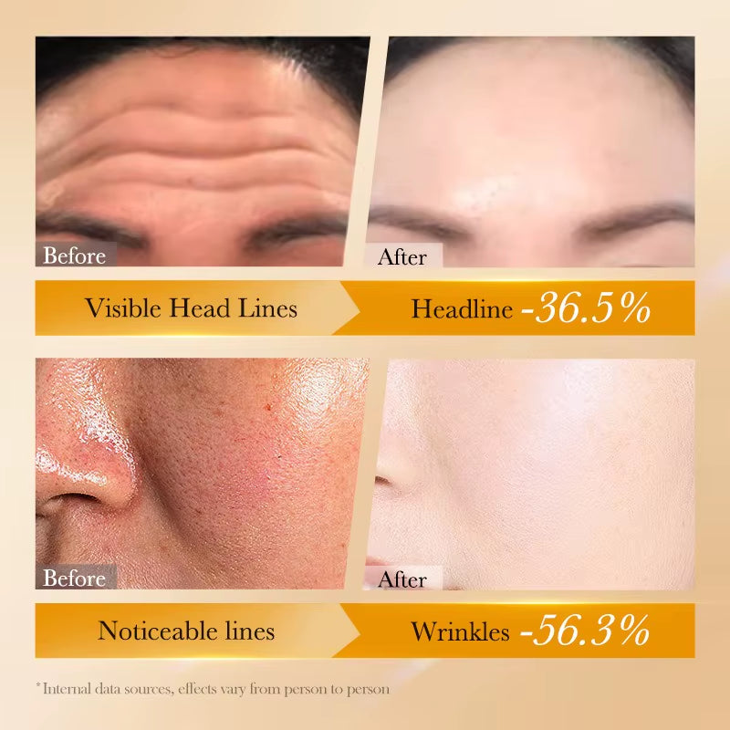 Retinol Peptide Skin Care Set Deeply Nourishes and Repairs Reduces Wrinkles and Fine Lines Lightens Dark Circles Pigmentation